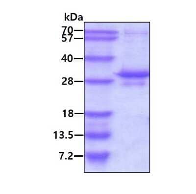 SDS-Page: Recombinant Human EGLN3/PHD3 His Protein [NBP2-53035] - 3ug by SDS-PAGE under reducing condition and visualized by coomassie blue stain.